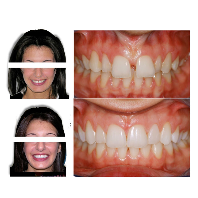 Dott.ssa Fioralba Baldaccini - Studio ortodontico a Frosinone - Specialista Invisalign - Dentista Frosinone Dott.ssa Fioralba Baldaccini - Studio ortodontico a Frosinone - Specialista Invisalign - Dentista Frosinone