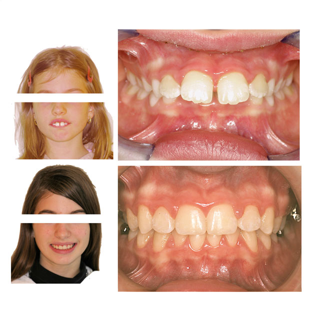 MAlocclusione dentista Frosinone MAlocclusione dentista Frosinone
