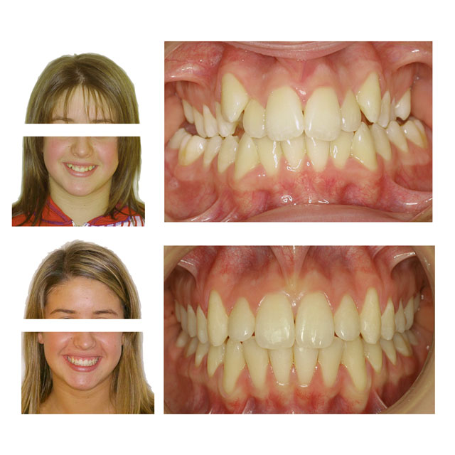 MAlocclusione dentista Frosinone MAlocclusione dentista Frosinone