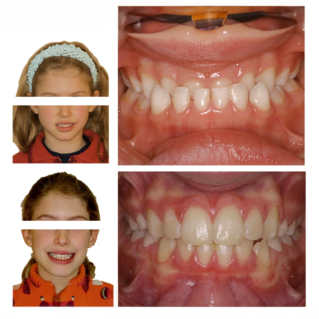 MAlocclusione dentista Frosinone MAlocclusione dentista Frosinone
