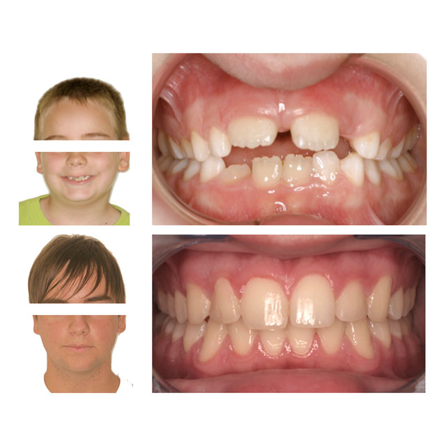 Dott.ssa Fioralba Baldaccini - Studio ortodontico a Frosinone - Specialista Invisalign - Dentista Frosinone Dott.ssa Fioralba Baldaccini - Studio ortodontico a Frosinone - Specialista Invisalign - Dentista Frosinone