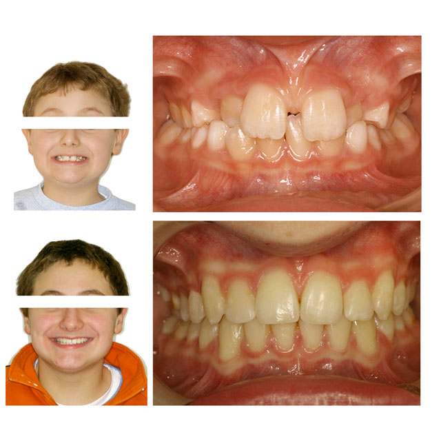 Dott.ssa Fioralba Baldaccini - Studio ortodontico a Frosinone - Specialista Invisalign - Dentista Frosinone Dott.ssa Fioralba Baldaccini - Studio ortodontico a Frosinone - Specialista Invisalign - Dentista Frosinone
