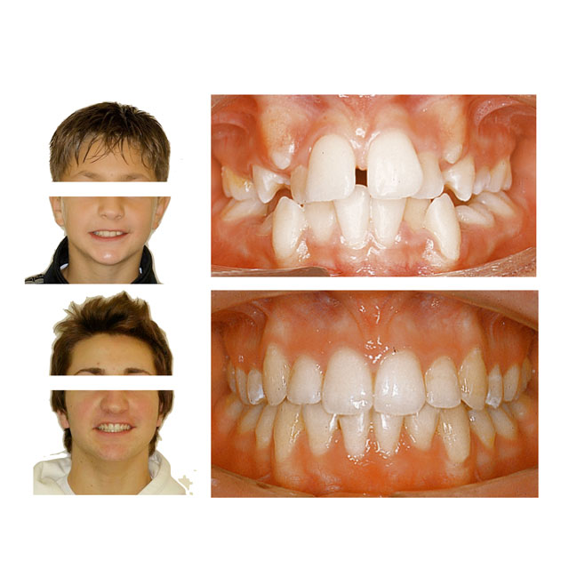Dott.ssa Fioralba Baldaccini - Studio ortodontico a Frosinone - Specialista Invisalign - Dentista Frosinone Dott.ssa Fioralba Baldaccini - Studio ortodontico a Frosinone - Specialista Invisalign - Dentista Frosinone